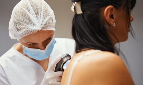 Czy do dermatologa potrzebne jest skierowanie?